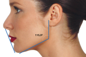 Análise da face em Harmonização Orofacial (parte II): a perspectiva lateral (perfil)