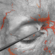 Anatomia facial: o mapa de nervos, músculos, vasos e tecidos